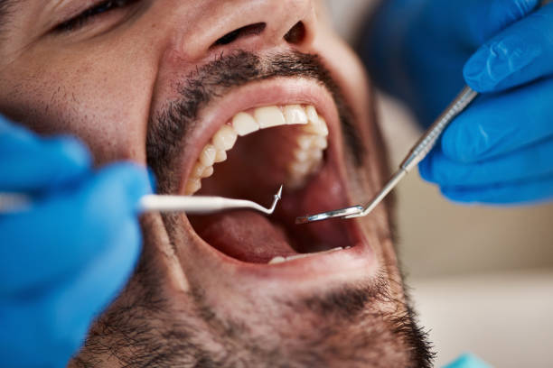Best Emergency Treatment for Oral Infections in Upper Montclair, NJ